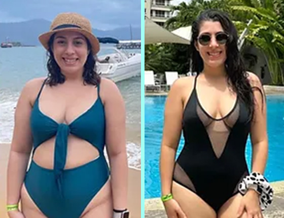 before after 10