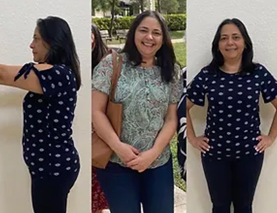 before after 13