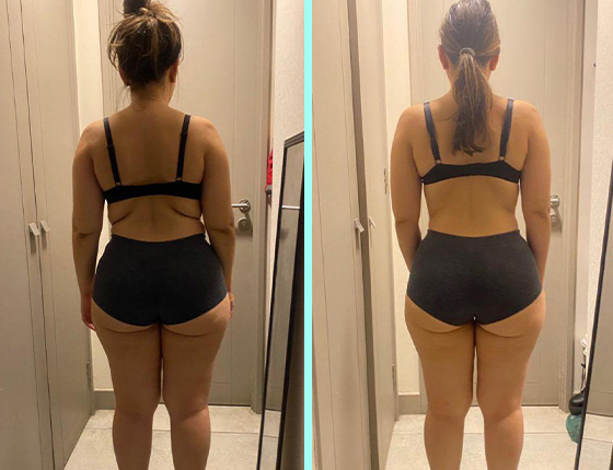 before after 15