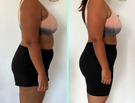 before after 16