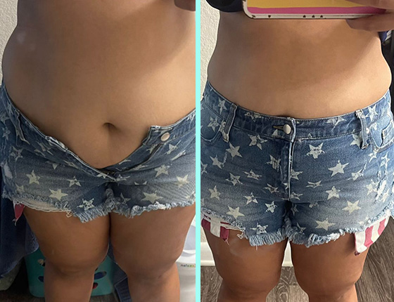 before after 2