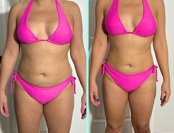 before after 3
