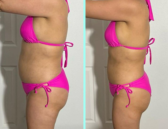 before after 4