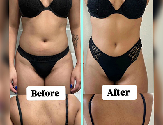 before after 5