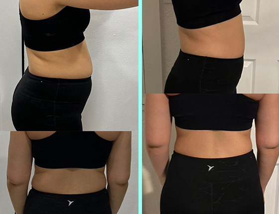 before after 7