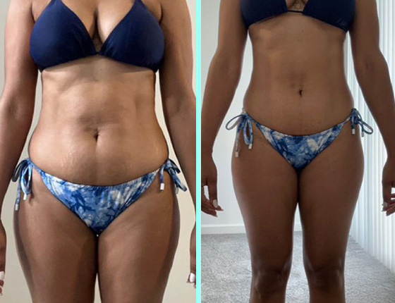 before after 8
